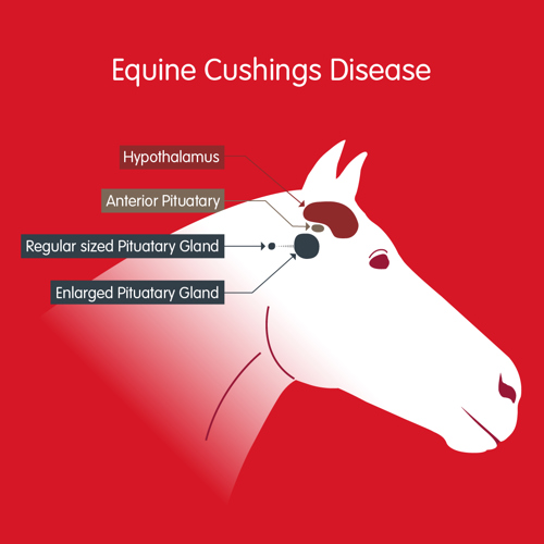 Visual showing the hypothalamus, anterior pituitary and comparison between a normal and enlarged pituitary gland.
